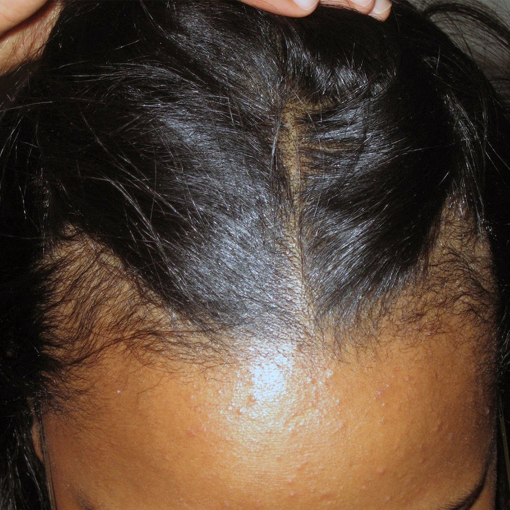 Solutions for Thinning Edges